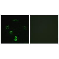 GLCTK Antibody 