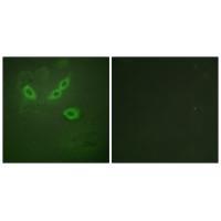 TUSC5 Antibody 