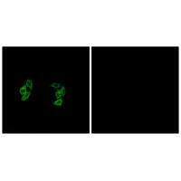 CKI-α1/L Antibody 
