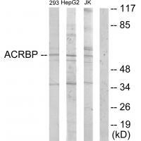 ACRBP Antibody 