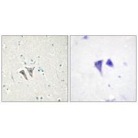 ACTR-1C Antibody