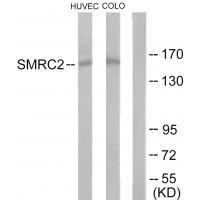 SMRC2 Antibody 