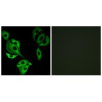ADCK4 Antibody 