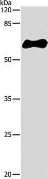 GST Tag Antibody