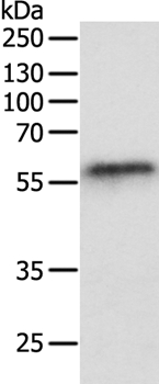 OCLN Antibody