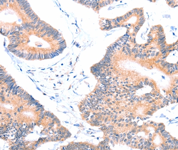 AOC1 Antibody