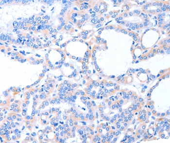 ACAD8 Antibody