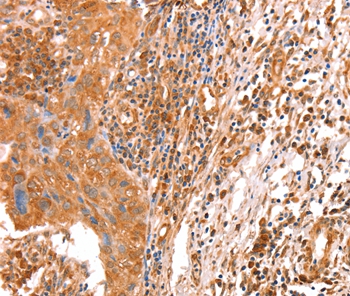 ACAD9 Antibody