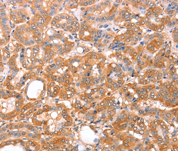 ACAD9 Antibody