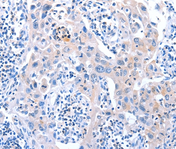 ACAD11 Antibody