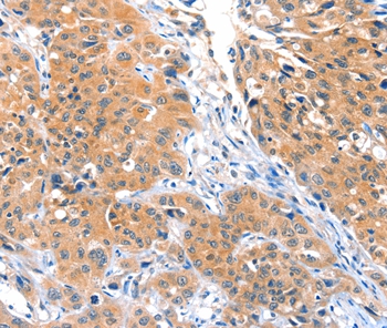 ACOX3 Antibody