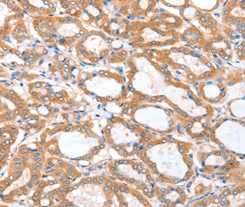 ACSBG1 Antibody