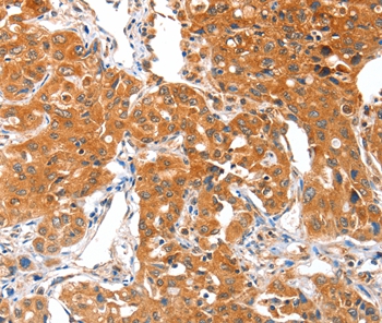 ACSBG1 Antibody