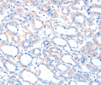 ACSM5 Antibody