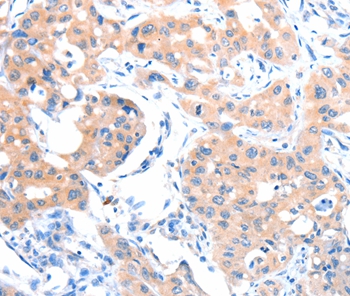 ACSM5 Antibody