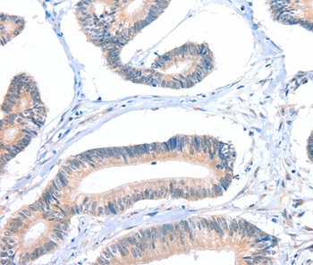 FHL5 Antibody