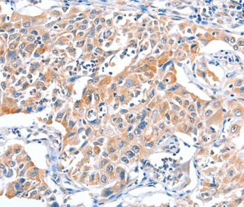 FHL5 Antibody