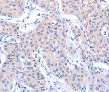 ACTR3B Antibody