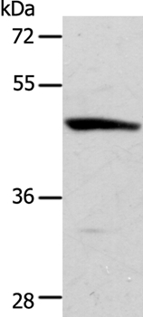 ACTR3B Antibody