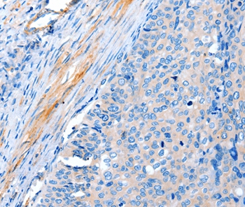 ACTRT1 Antibody