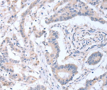 ACOT9 Antibody