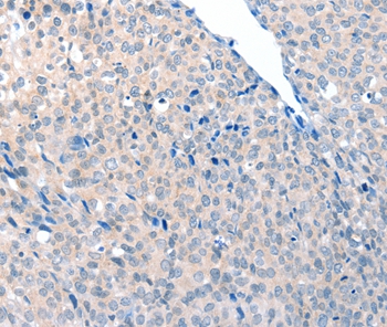 ACOT8 Antibody