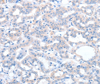 ACOT8 Antibody