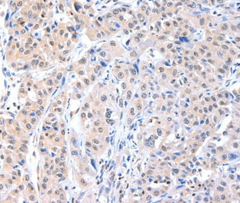 ADAM15 Antibody