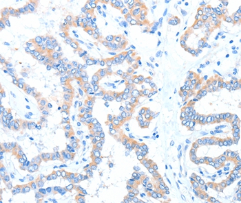 ADAM17 Antibody