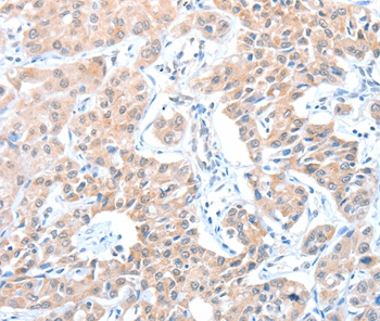 ADAM21 Antibody