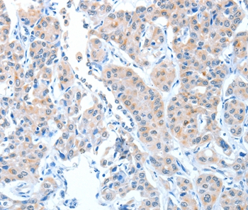 ADAMTSL1 Antibody