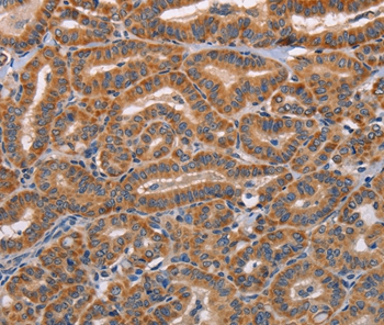 ADAMDEC1 Antibody