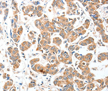 AEBP2 Antibody