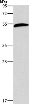 AEBP2 Antibody