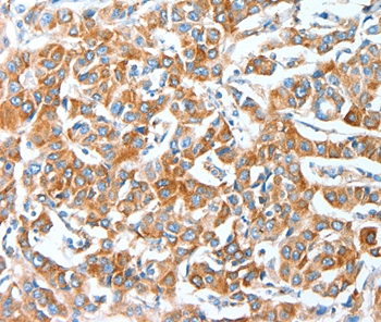 AFAP1 Antibody