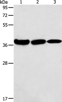 AGA Antibody