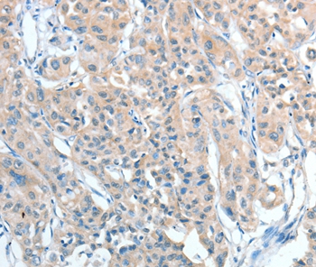 AGBL2 Antibody