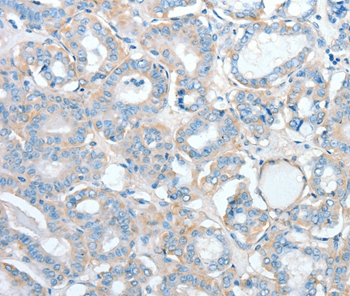 AGBL2 Antibody