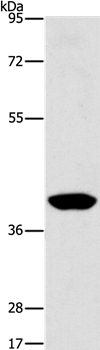 AGXT2L2 Antibody