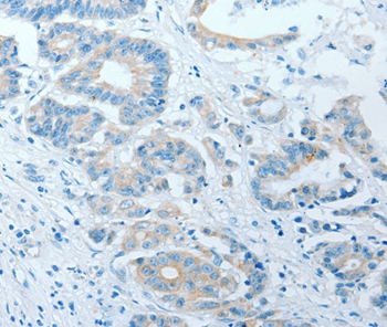 AKAP7 Antibody