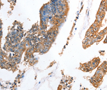 AKR1D1 Antibody