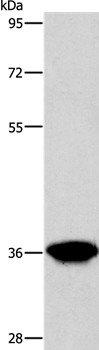 AKR1D1 Antibody