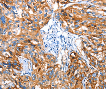 AOX1 Antibody