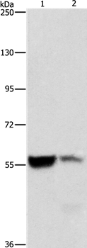 ALDH8A1 Antibody