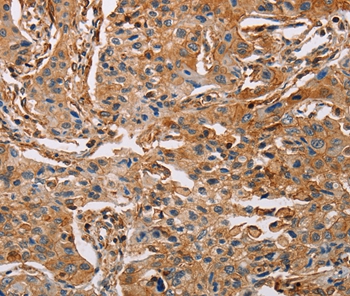 ACTA1 Antibody