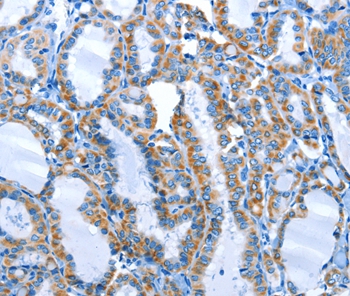 ALPK1 Antibody