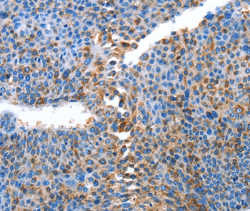 ALPK1 Antibody