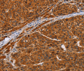 NIF3L1 Antibody