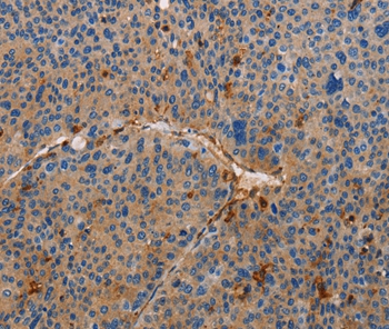 AMBRA1 Antibody