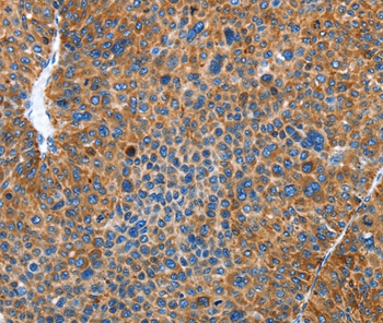 AUP1 Antibody